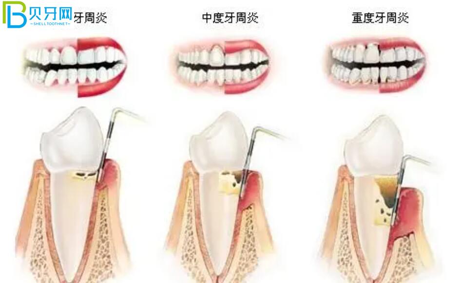 南昌达芬奇口腔活动